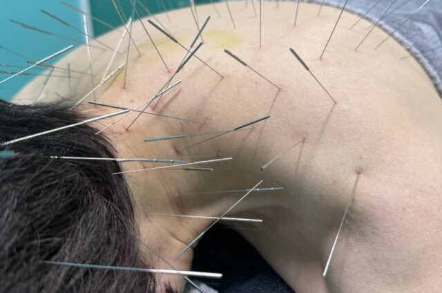 寝違え、福岡市南区野間、高宮、多賀宏之、院長