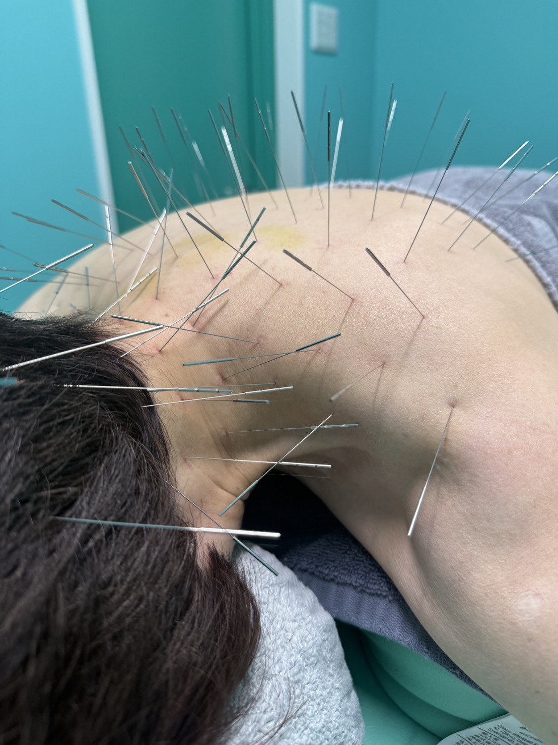 寝違え、福岡市南区野間、高宮、多賀宏之、院長