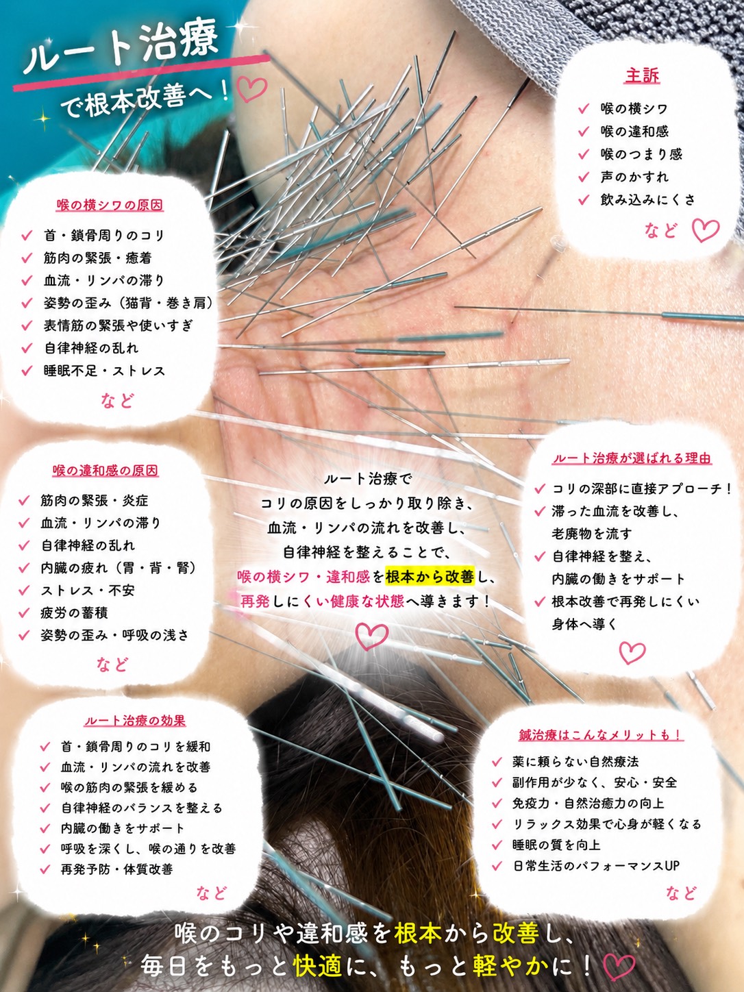 喉のシワ、喉の違和感、ルート治療、ルート鍼、福岡市南区、高宮駅