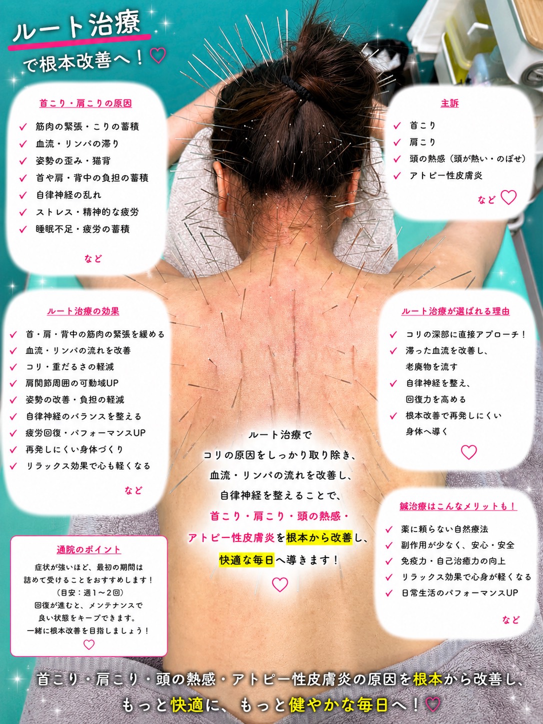 アトピー性皮膚炎、痒み、肌荒れ、ルート治療、ルート鍼、福岡市南区、高宮駅