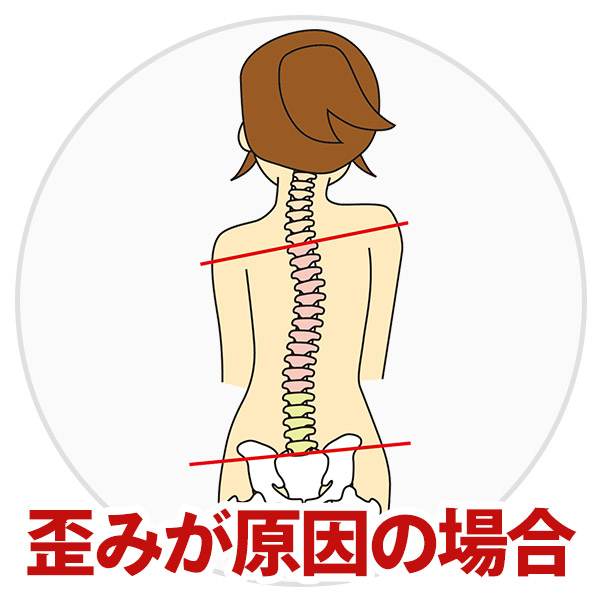 歪みが原因の場合